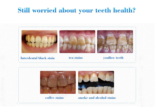Blanchissement Des Dentaire - EFERO